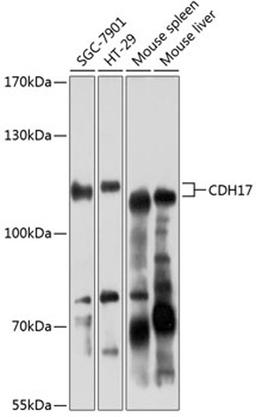 Western blot - CDH17 antibody (A6555)