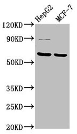 Western Blot. Positive WB detected in: HepG2 whole cell lysate, MCF-7 whole cell lysate. All lanes: FPGS antibody at 3.2µg/ml. Secondary. Goat polyclonal to rabbit IgG at 1/50000 dilution. Predicted band size: 65, 61, 60, 62 kDa. Observed band size: 65 kDa