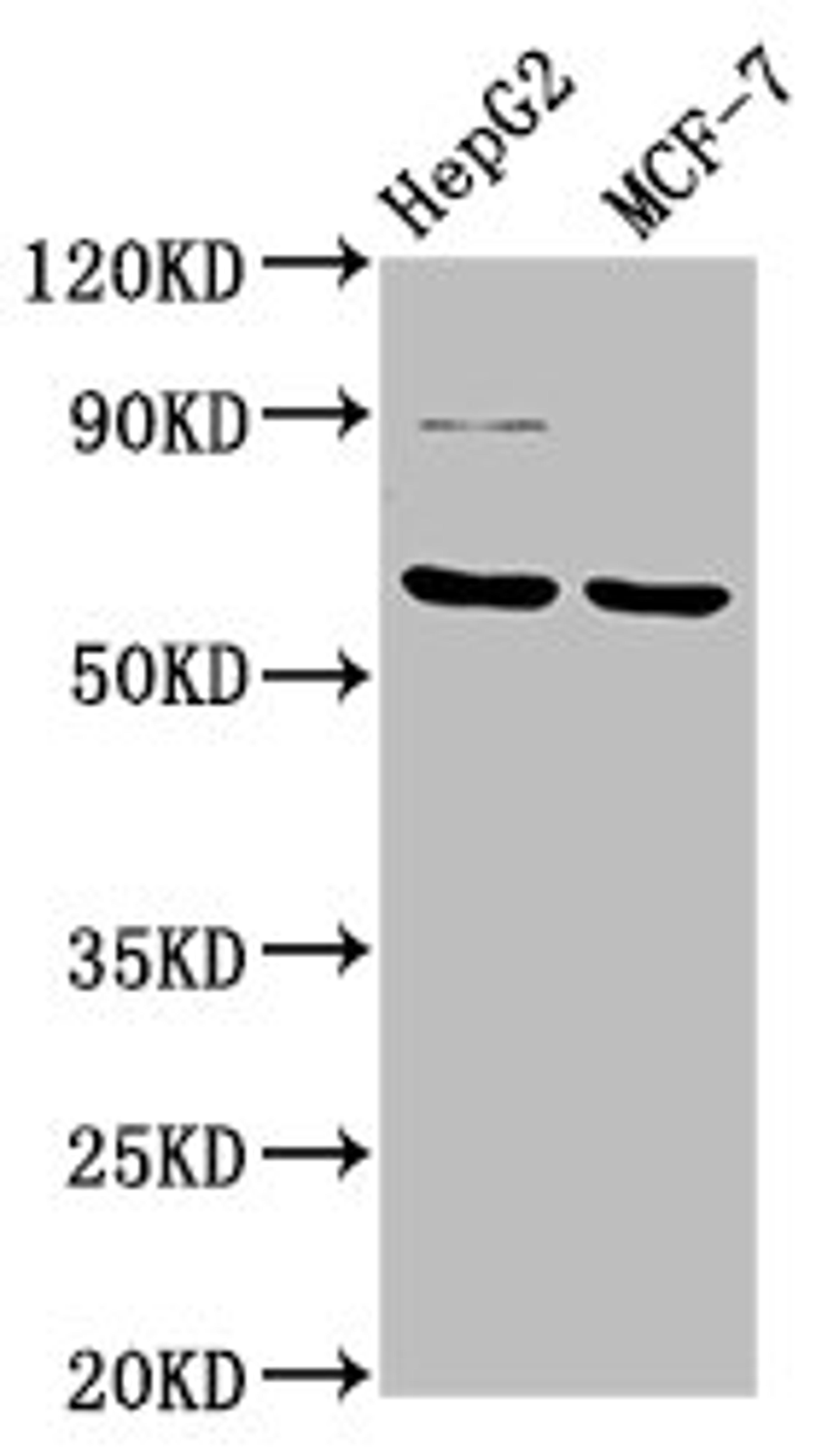 Western Blot. Positive WB detected in: HepG2 whole cell lysate, MCF-7 whole cell lysate. All lanes: FPGS antibody at 3.2µg/ml. Secondary. Goat polyclonal to rabbit IgG at 1/50000 dilution. Predicted band size: 65, 61, 60, 62 kDa. Observed band size: 65 kDa