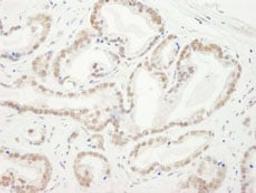 Detection of human CBX5 by immunohistochemistry.