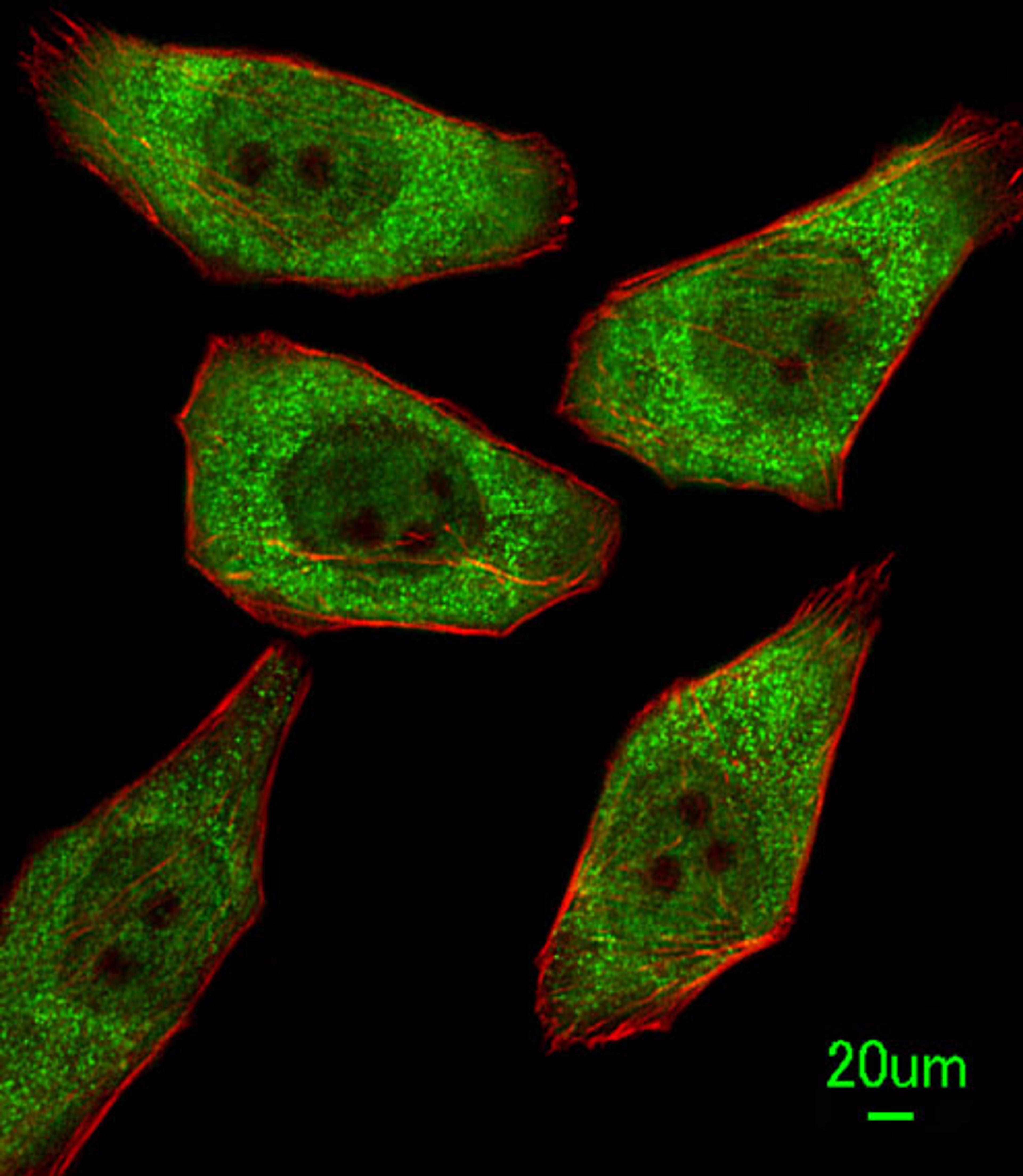 Immunofluorescent analysis of A549 cells, using FDPS Antibody . Antibody was diluted at 1:100 dilution. Alexa Fluor 488-conjugated goat anti-rabbit lgG at 1:400 dilution was used as the secondary antibody (green). Cytoplasmic actin was counterstained with