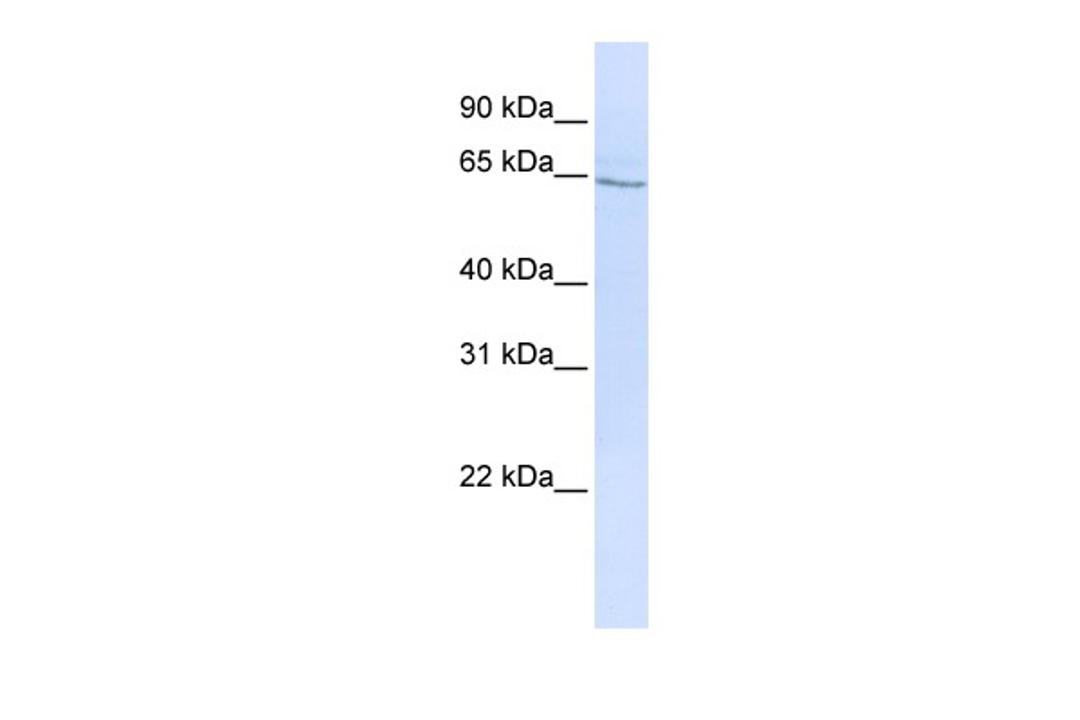 Antibody used in WB on Human HepG2 at 0.2-1 ug/ml.