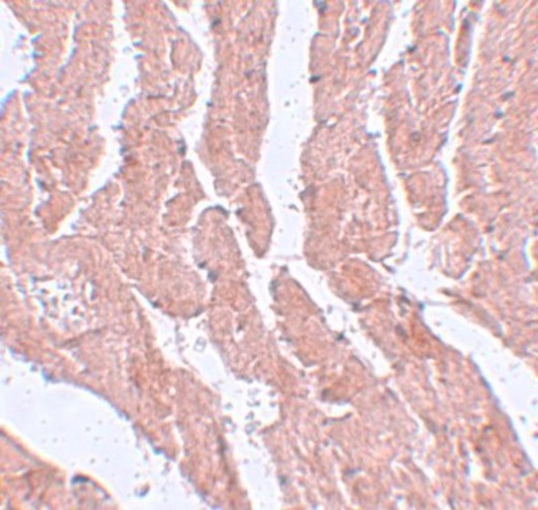 Immunohistochemistry-Paraffin: LZTR1 Antibody [NBP1-77121] - Mouse heart tissue with LZTR1 antibody at 5 ug/mL.