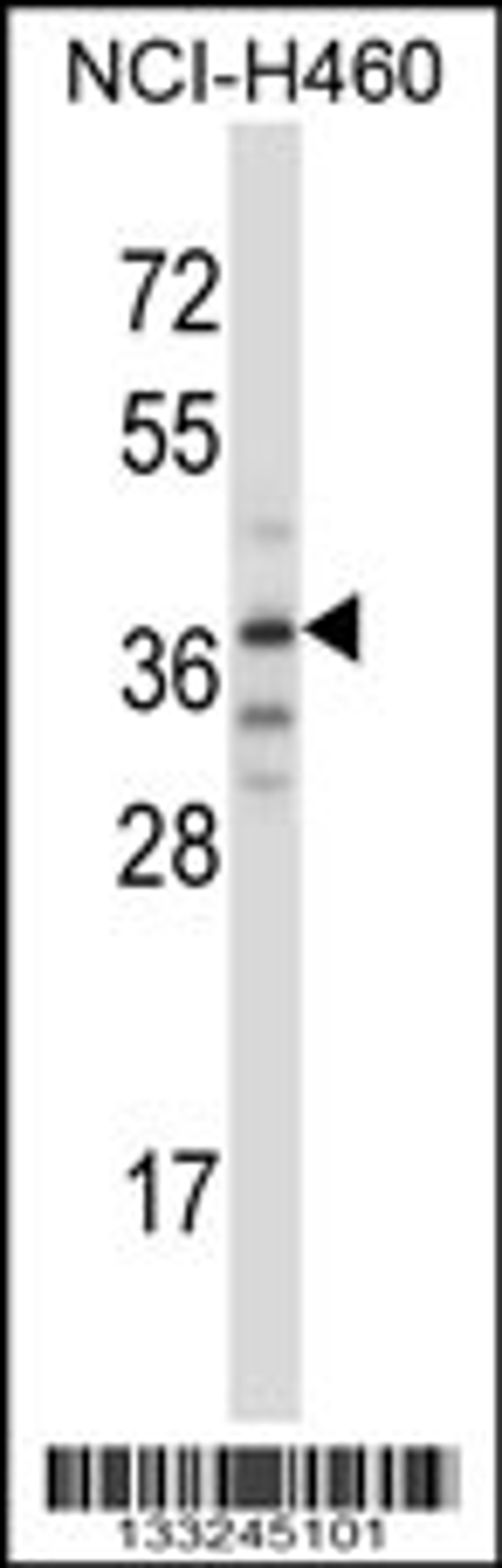 Western blot analysis in NCI-H460 cell line lysates (35ug/lane).