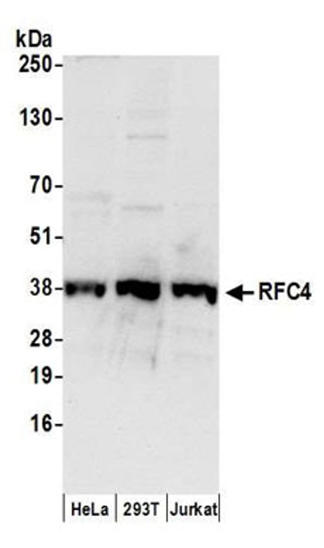 Detection of human RFC4 by western blot.