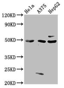 Western Blot. Positive WB detected in: Hela whole cell lysate, A375 whole cell lysate, HepG2 whole cell lysate. All lanes: STK24 antibody at 3µg/ml. Secondary. Goat polyclonal to rabbit IgG at 1/50000 dilution. Predicted band size: 50, 48 kDa. Observed band size: 50 kDa