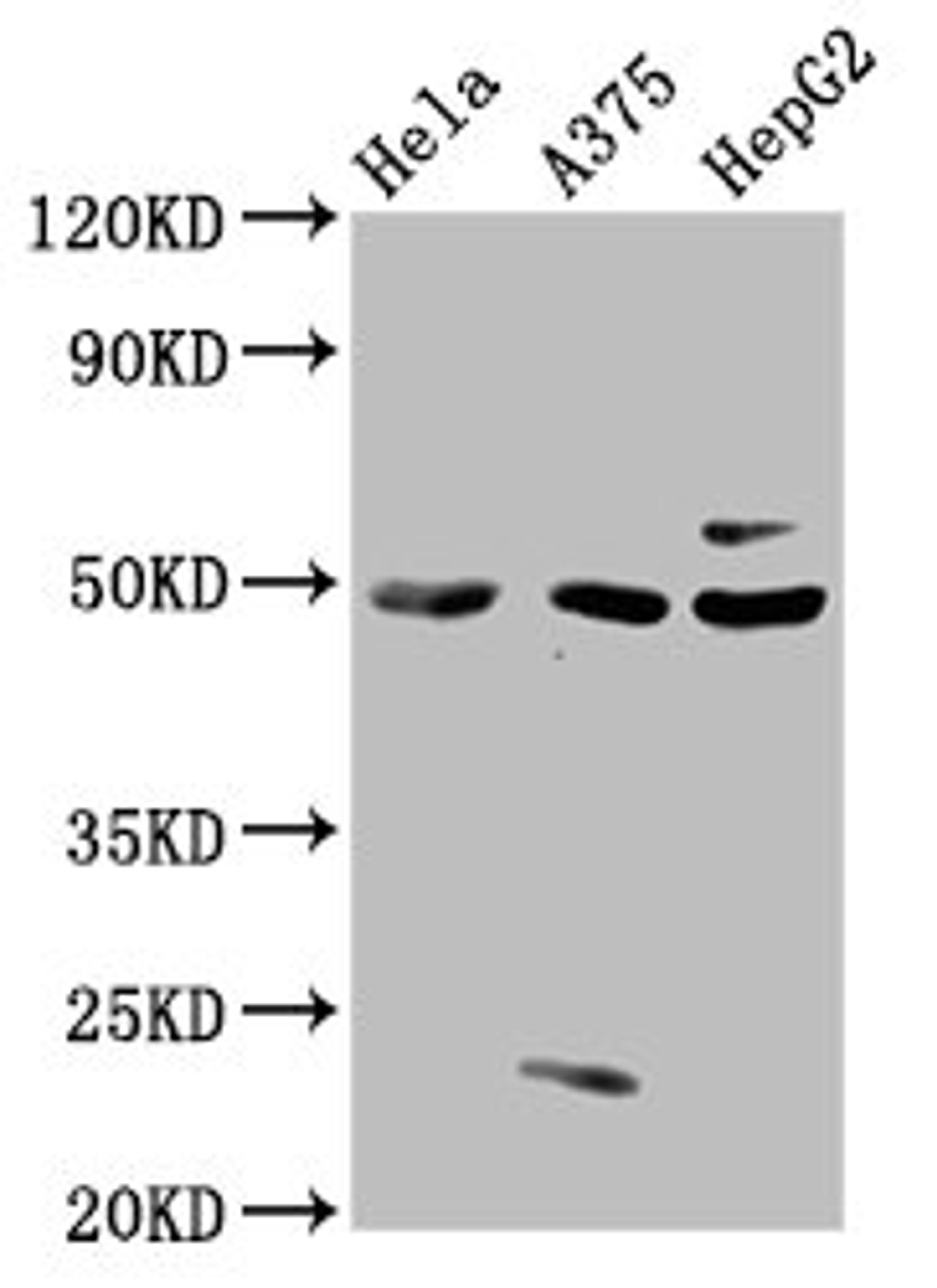 Western Blot. Positive WB detected in: Hela whole cell lysate, A375 whole cell lysate, HepG2 whole cell lysate. All lanes: STK24 antibody at 3µg/ml. Secondary. Goat polyclonal to rabbit IgG at 1/50000 dilution. Predicted band size: 50, 48 kDa. Observed band size: 50 kDa