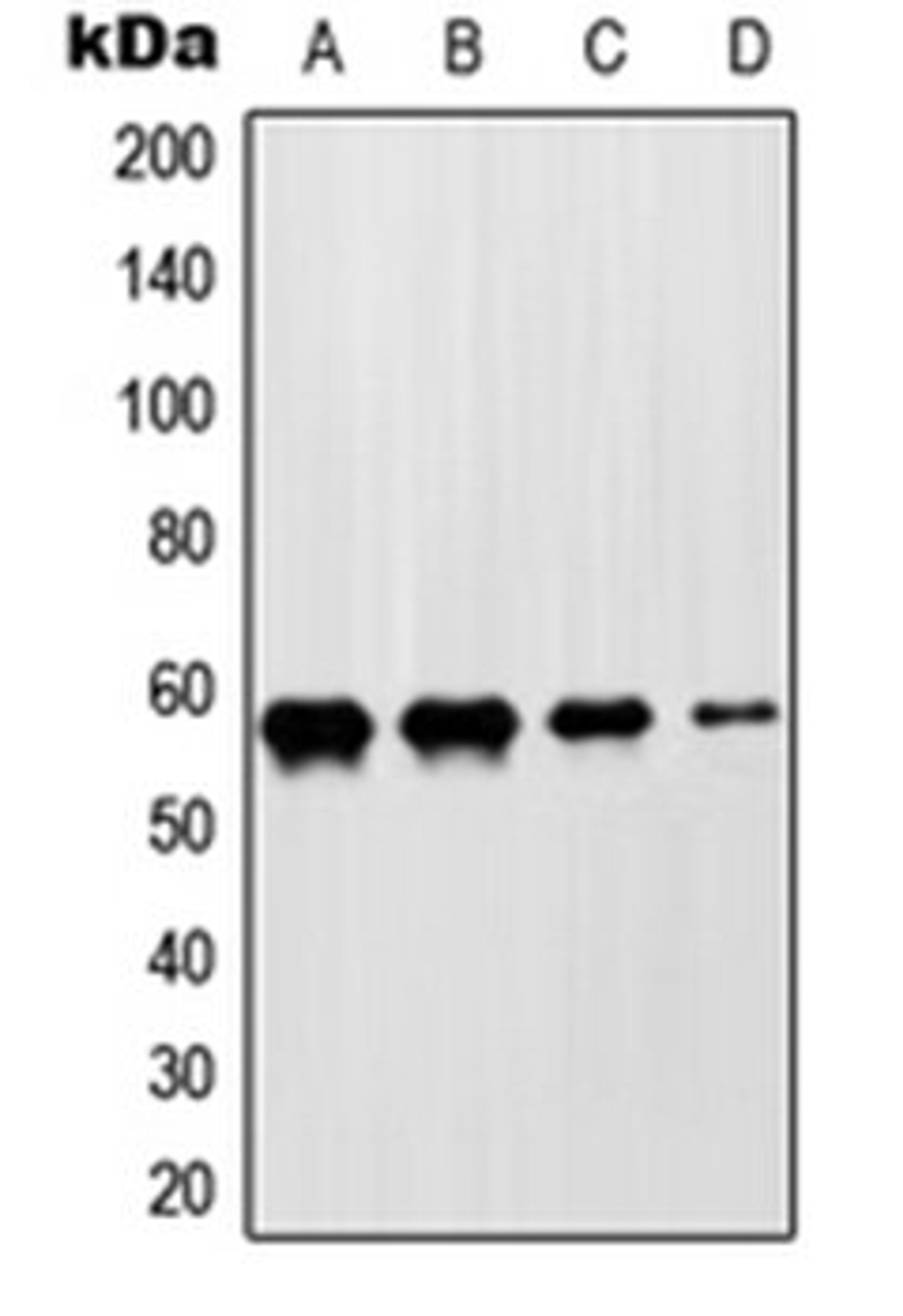 Western blot analysis of HeLa (Lane 1), Jurkat (Lane 2), NIH3T3 (Lane 3), H9C2 (Lane 4) whole cell lysates using ZNF682 antibody