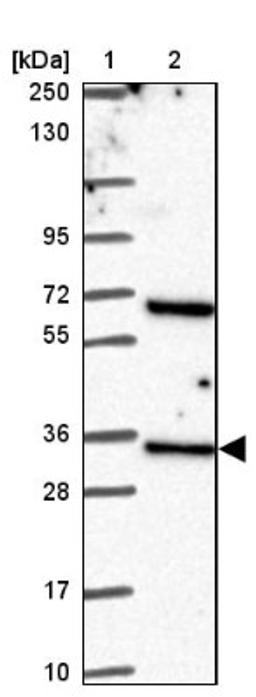 Western Blot: Lin28B Antibody [NBP2-32352] - Lane 1: Marker [kDa] 250, 130, 95, 72, 55, 36, 28, 17, 10<br/>Lane 2: Human cell line RT-4