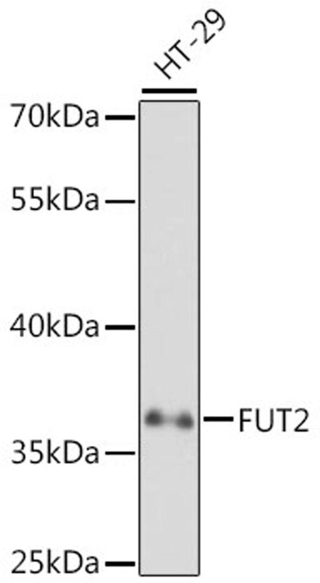 Western blot - FUT2 antibody (A5721)