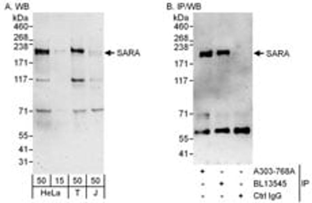 Detection of human SARA by western blot and immunoprecipitation.