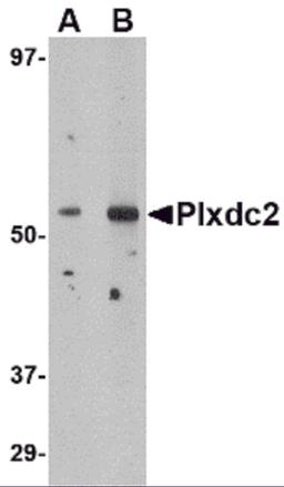 Western blot analysis of Plxdc2 in human brain tissue lysate with Plxdc2 antibody at (A) 0.5 (B) 1 &#956;g/mL.