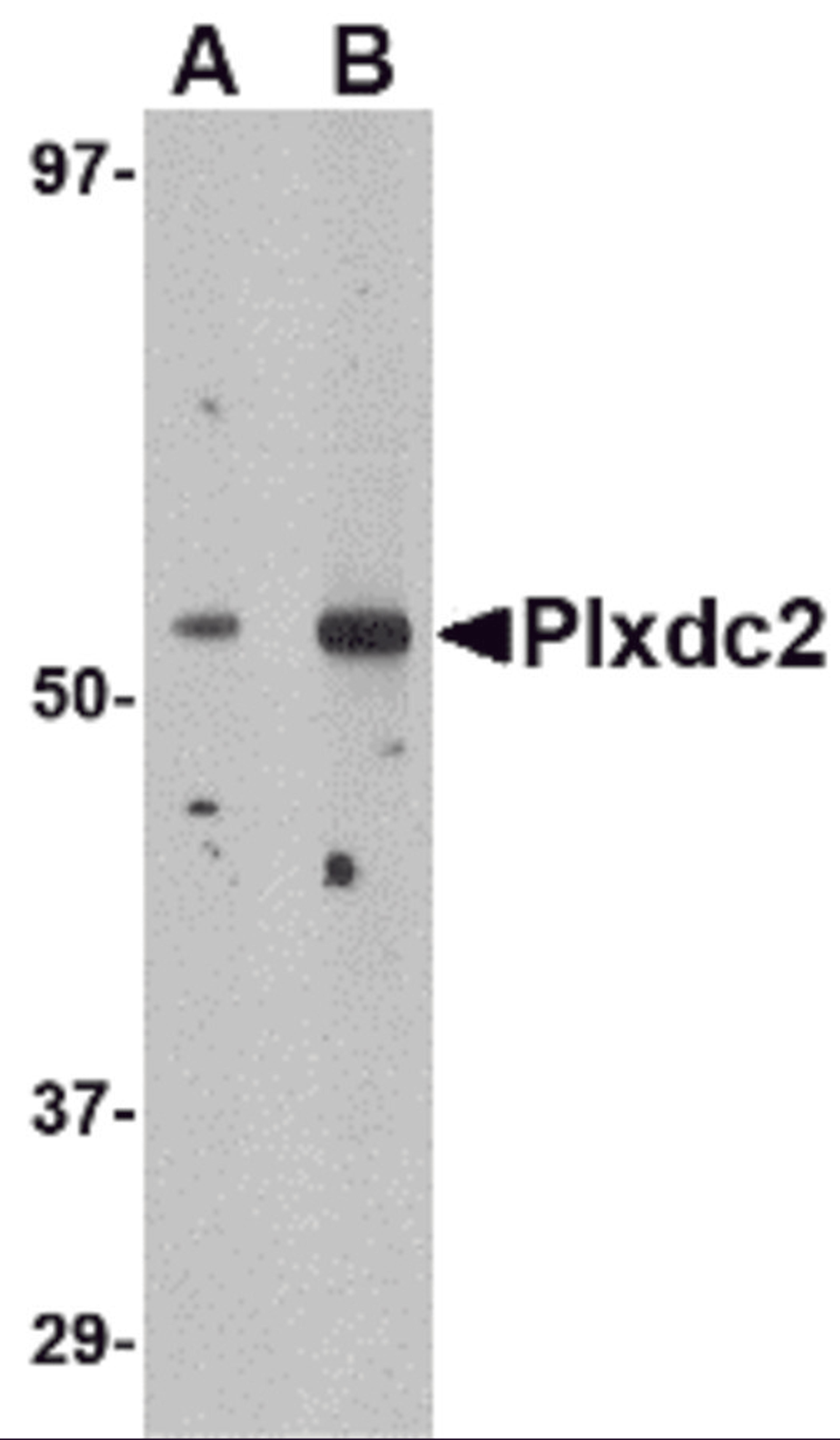 Western blot analysis of Plxdc2 in human brain tissue lysate with Plxdc2 antibody at (A) 0.5 (B) 1 &#956;g/mL.