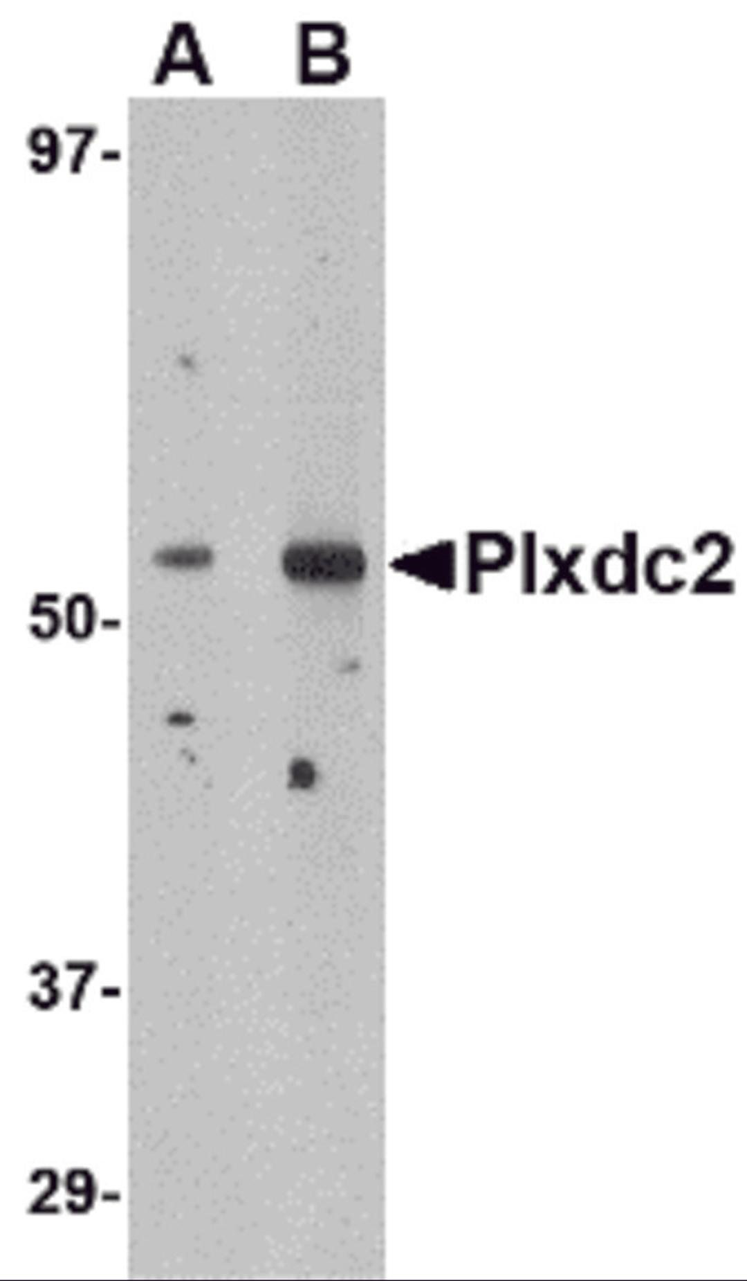 Western blot analysis of Plxdc2 in human brain tissue lysate with Plxdc2 antibody at (A) 0.5 (B) 1 μg/mL.