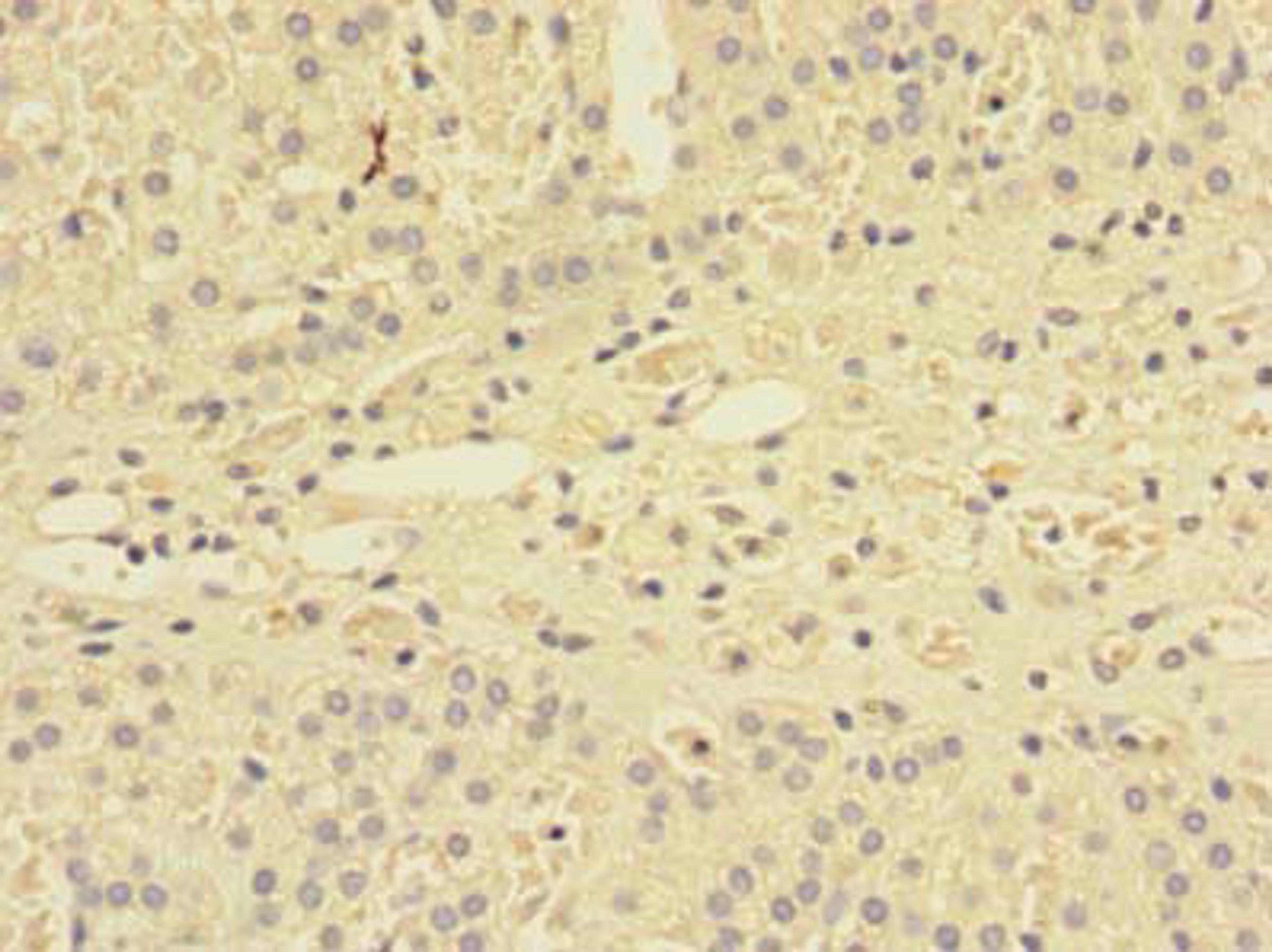 Immunohistochemistry of paraffin-embedded human adrenal gland tissue using CSB-PA818677LA01HU at dilution of 1:100