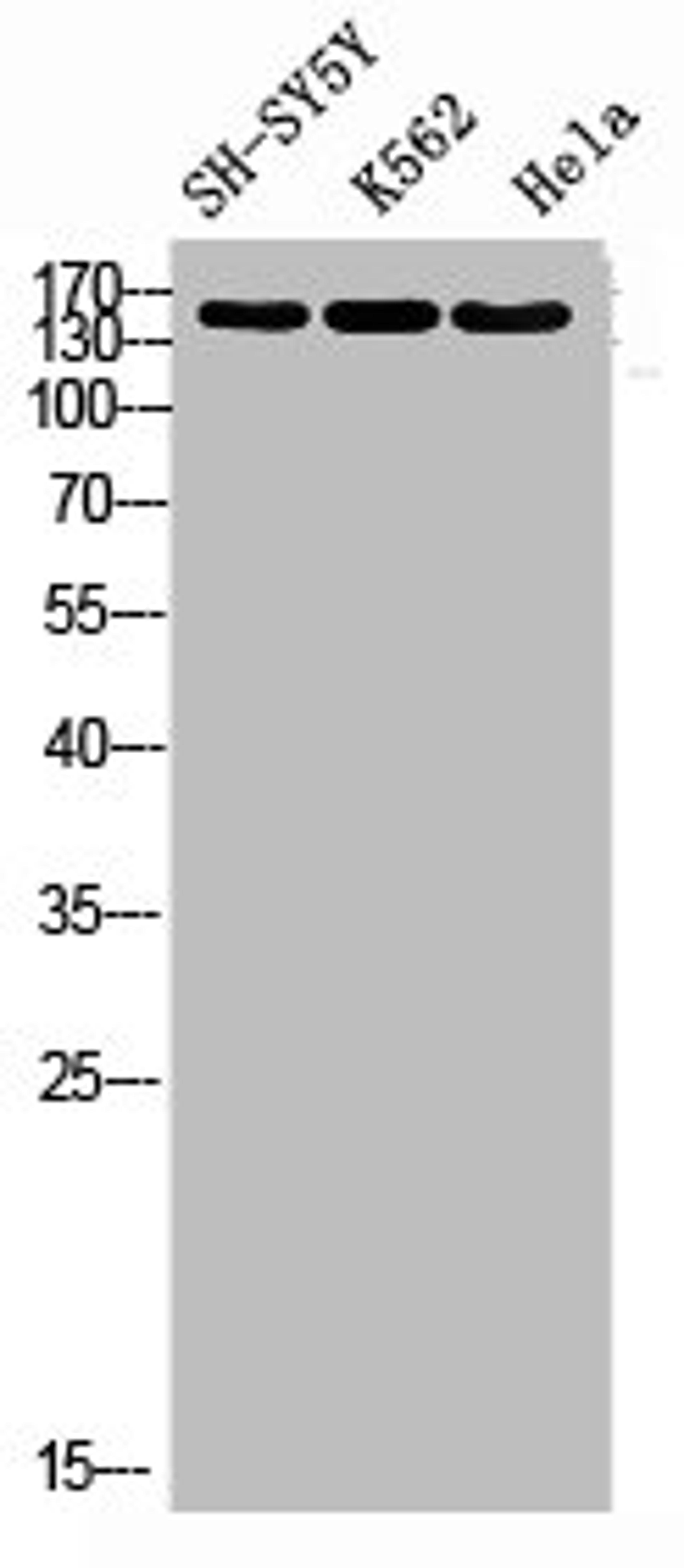 Western blot analysis of SH-SY5Y K562 HELA using RNase III Drosha antibody. Antibody was diluted at 1:1000. Secondary antibody  was diluted at 1:20000