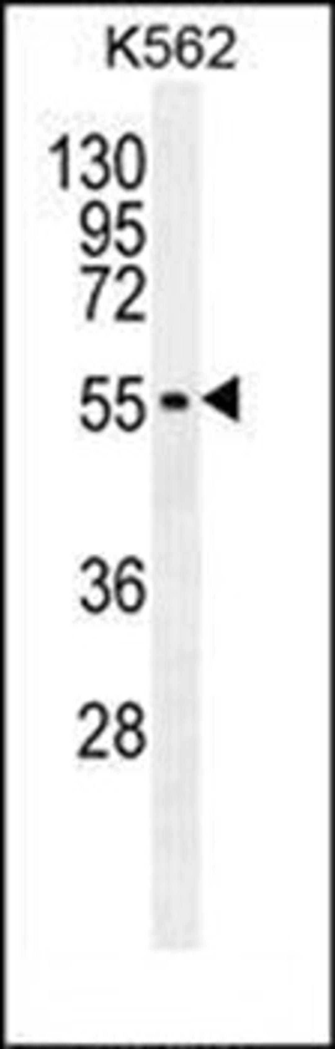 Western blot analysis of K562 cell line lysates (35ug/lane) using MITF antibody