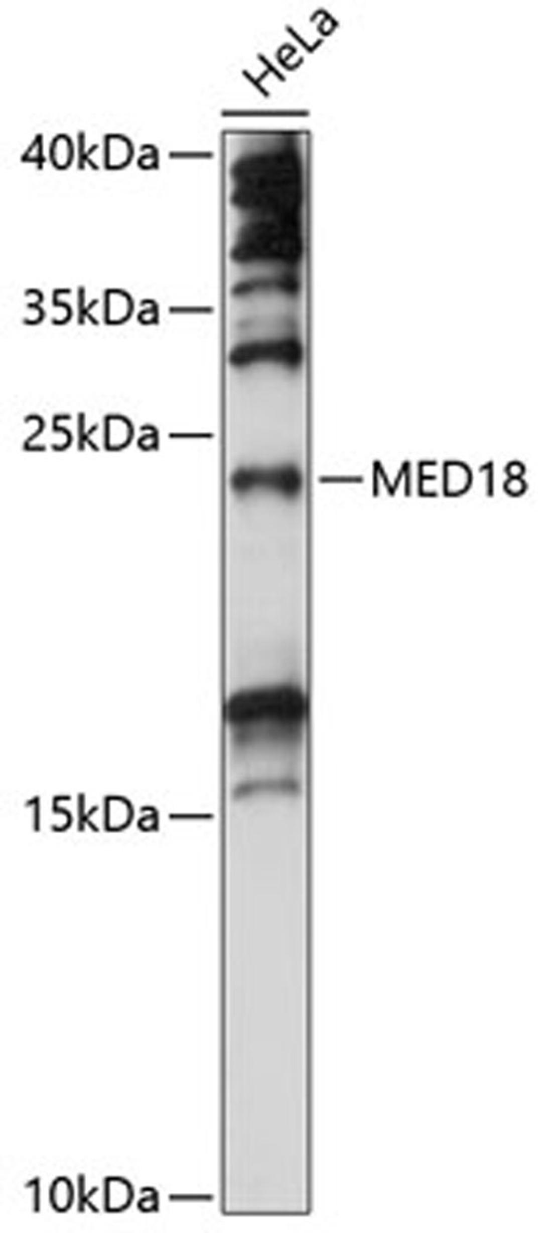 Western blot - MED18 antibody (A14588)