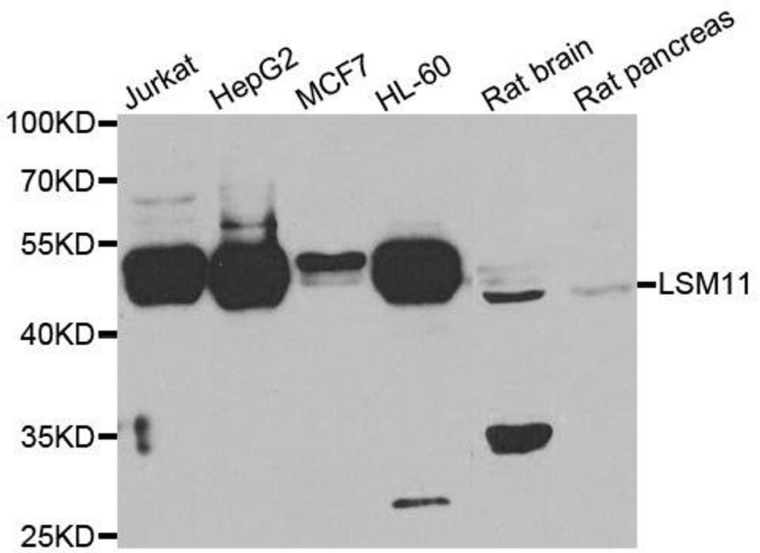 Western blot analysis of extracts of various cell lines using LSM11 antibody