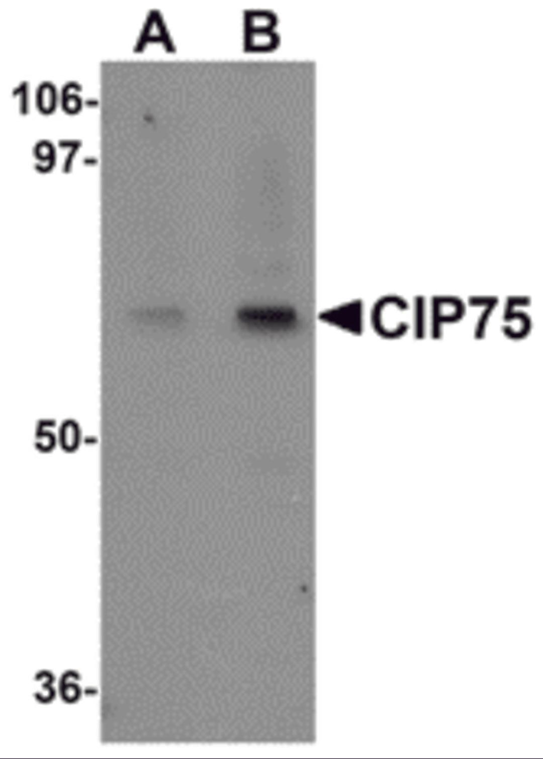 Western blot analysis of CIP75 in 3T3 cell lysate with CIP75 antibody at (A) 1 and (B) 2 μg/mL.