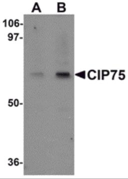 Western blot analysis of CIP75 in 3T3 cell lysate with CIP75 antibody at (A) 1 and (B) 2 μg/mL.