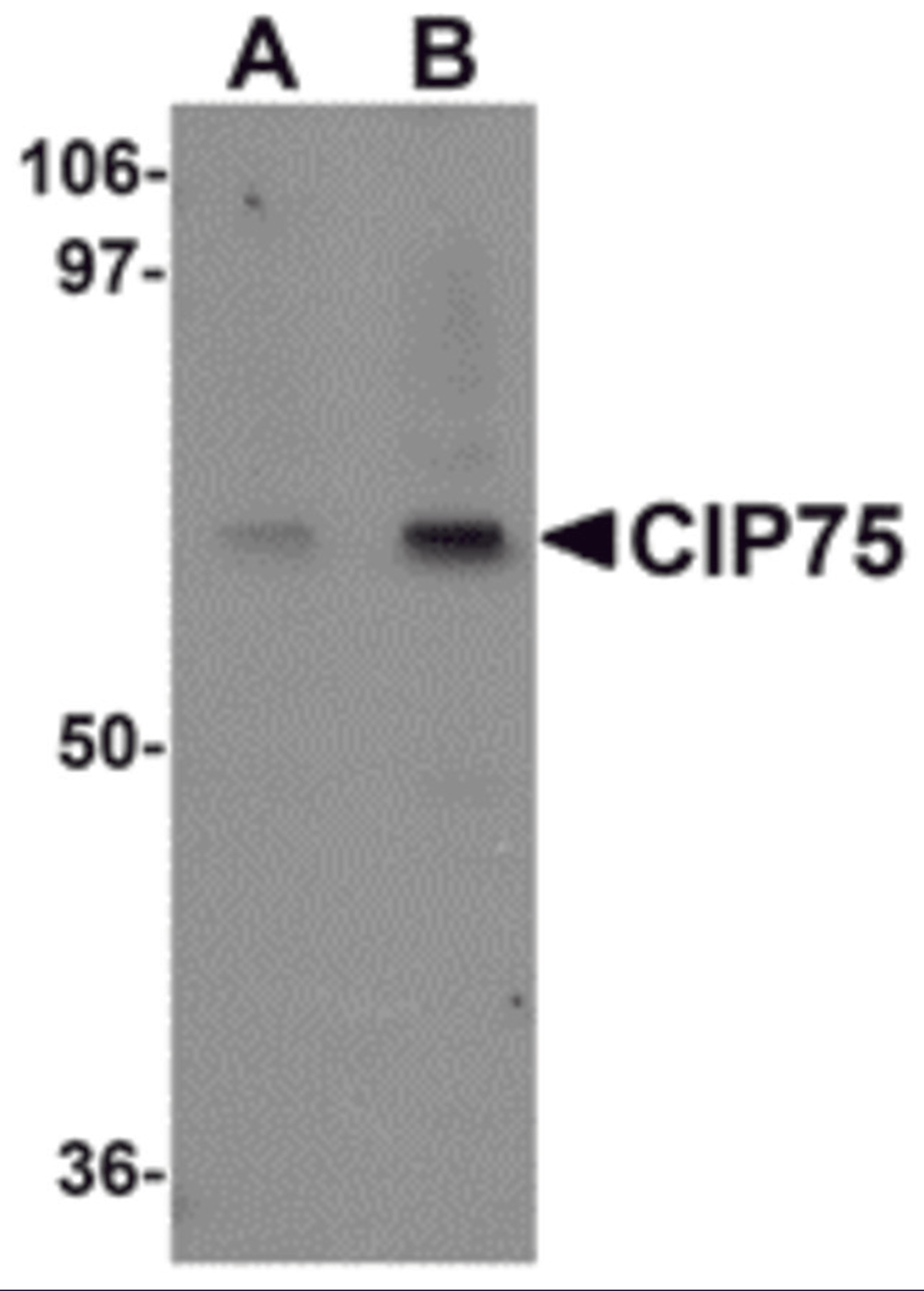 Western blot analysis of CIP75 in 3T3 cell lysate with CIP75 antibody at (A) 1 and (B) 2 μg/mL.