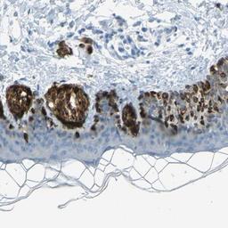 Immunohistochemistry-Paraffin: TRP2 Antibody [NBP1-86893] - Staining of human skin shows strong cytoplasmic positivity in melanocytes.