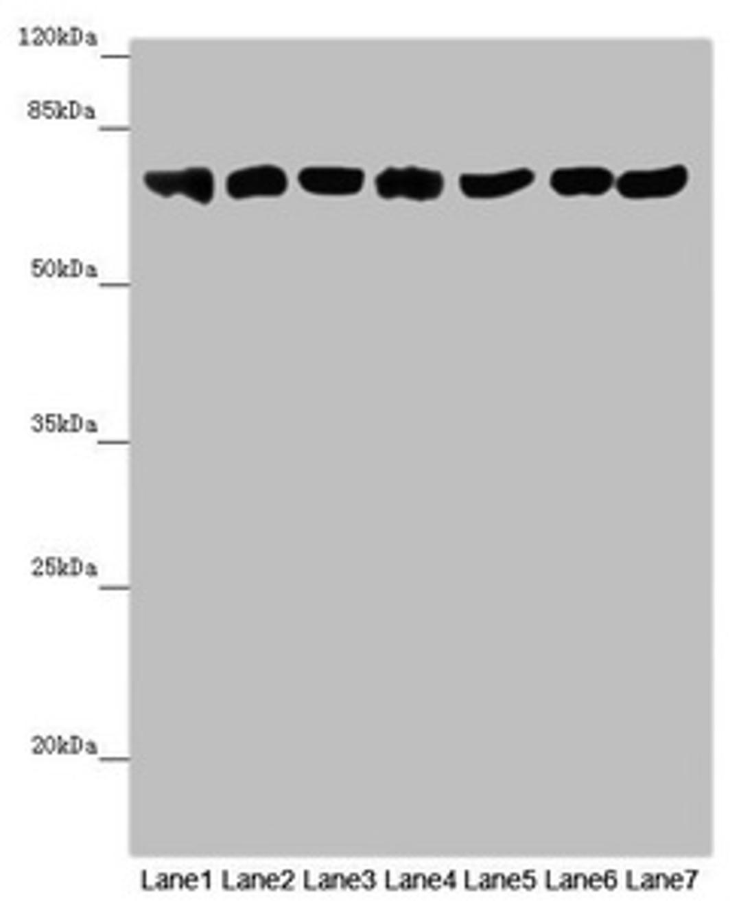 Western blot. All lanes: EFHC1 antibody at 9.9 ug/ml. Lane 1: Mouse large intestine tissue. Lane 2: Mouse stomach tissue. Lane 3: Mouse brain tissue. Lane 4: Mouse kidney tissue. Lane 5: Mouse gonadal tissue. Lane 6: Hela whole cell lysate. Lane 7: 293T whole cell lysate. Secondary. Goat polyclonal to rabbit IgG at 1/10000 dilution. Predicted band size: 74, 32, 73 kDa. Observed band size: 74 kDa.