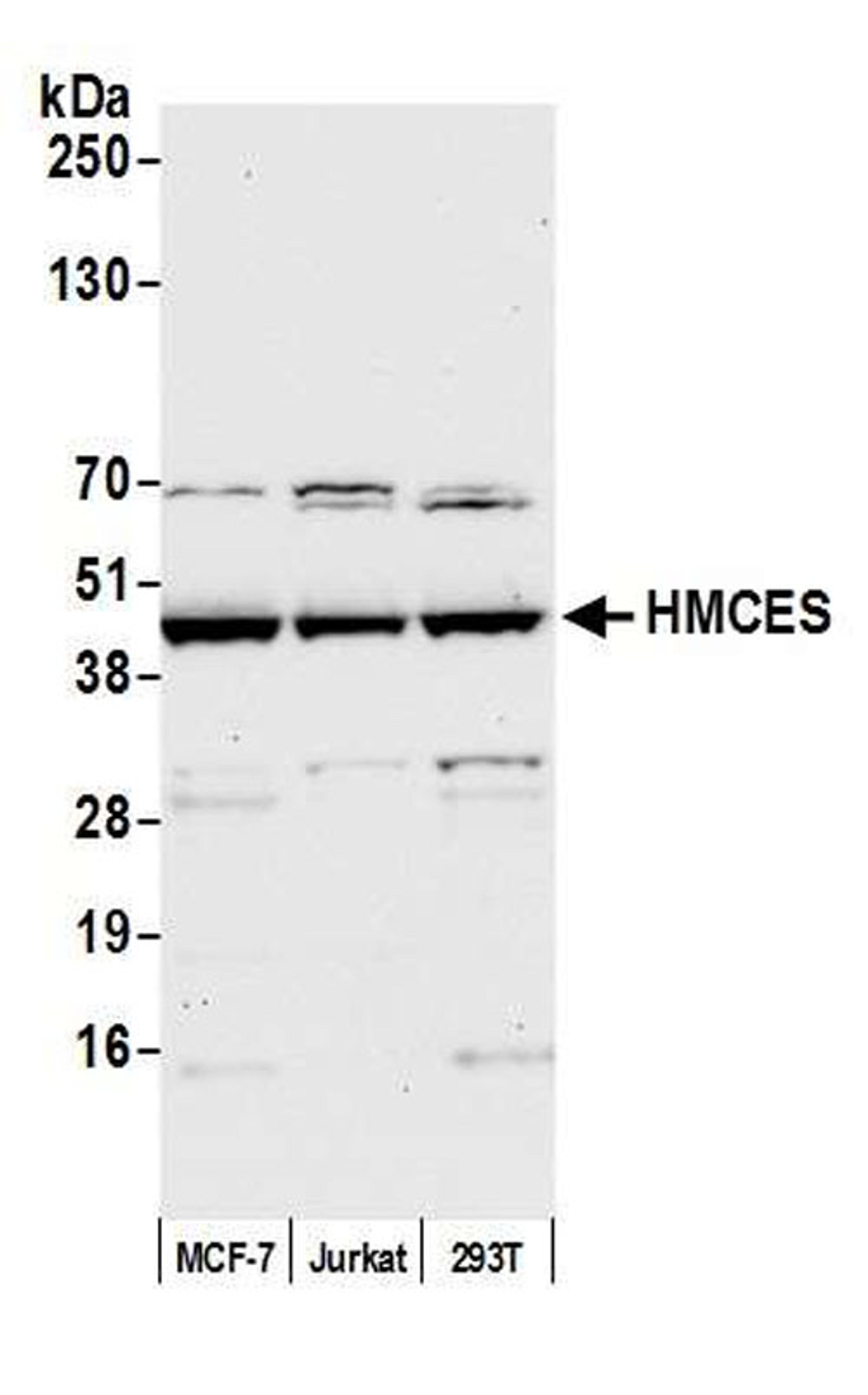 Detection of human HMCES by WB.