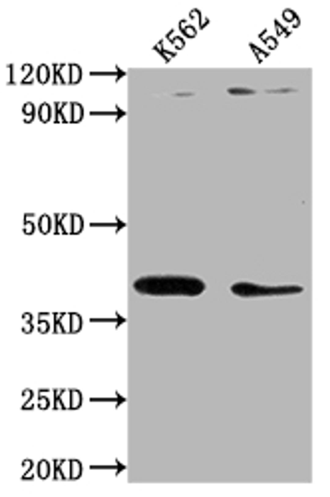 Western Blot. Positive WB detected in: K562 whole cell lysate, A549 whole cell lysate. All lanes: TMOD1 antibody at 1:1000. Secondary. Goat polyclonal to rabbit IgG at 1/50000 dilution. Predicted band size: 41, 27 kDa. Observed band size: 41 kDa.