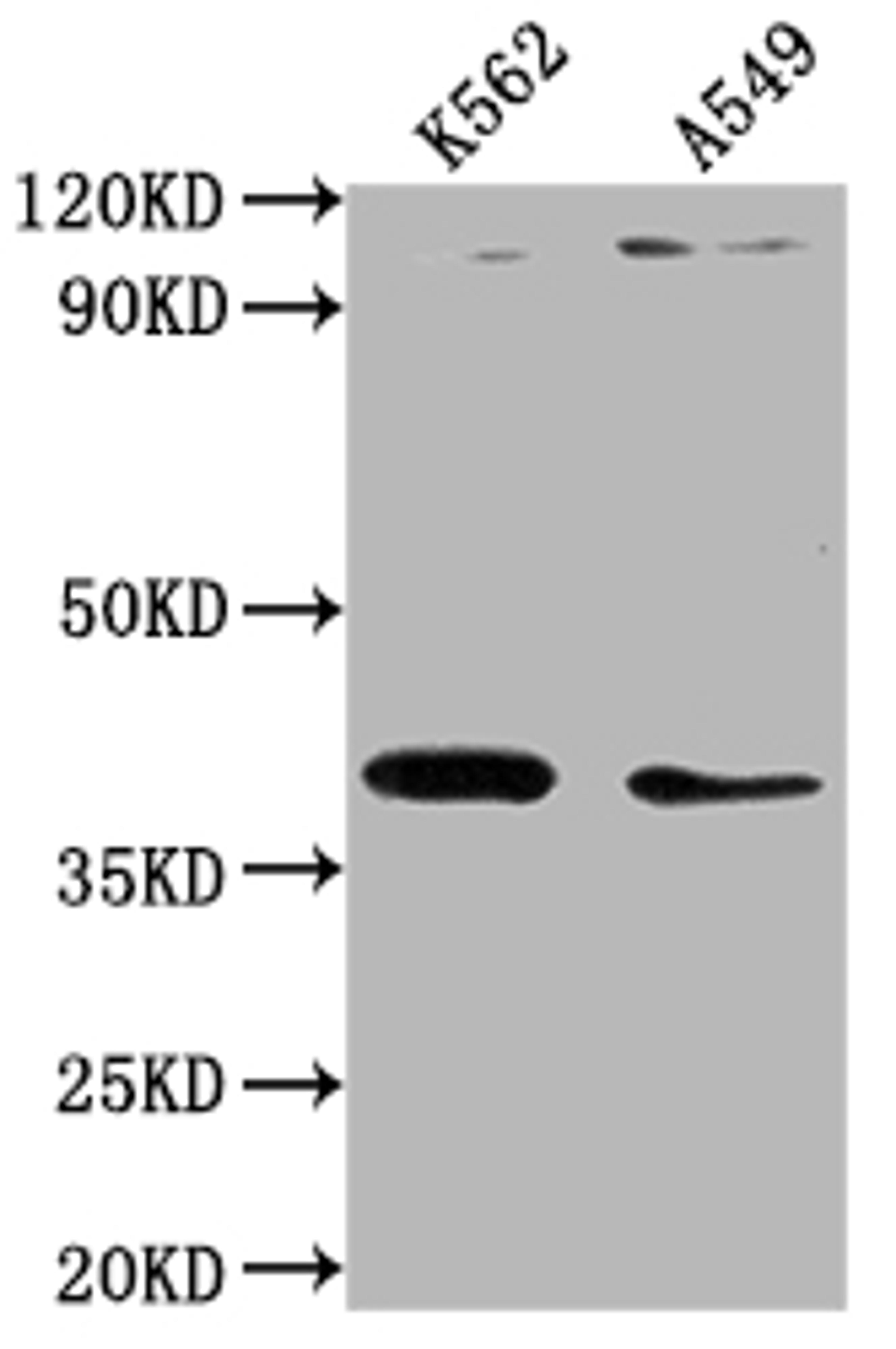 Western Blot. Positive WB detected in: K562 whole cell lysate, A549 whole cell lysate. All lanes: TMOD1 antibody at 1:1000. Secondary. Goat polyclonal to rabbit IgG at 1/50000 dilution. Predicted band size: 41, 27 kDa. Observed band size: 41 kDa.