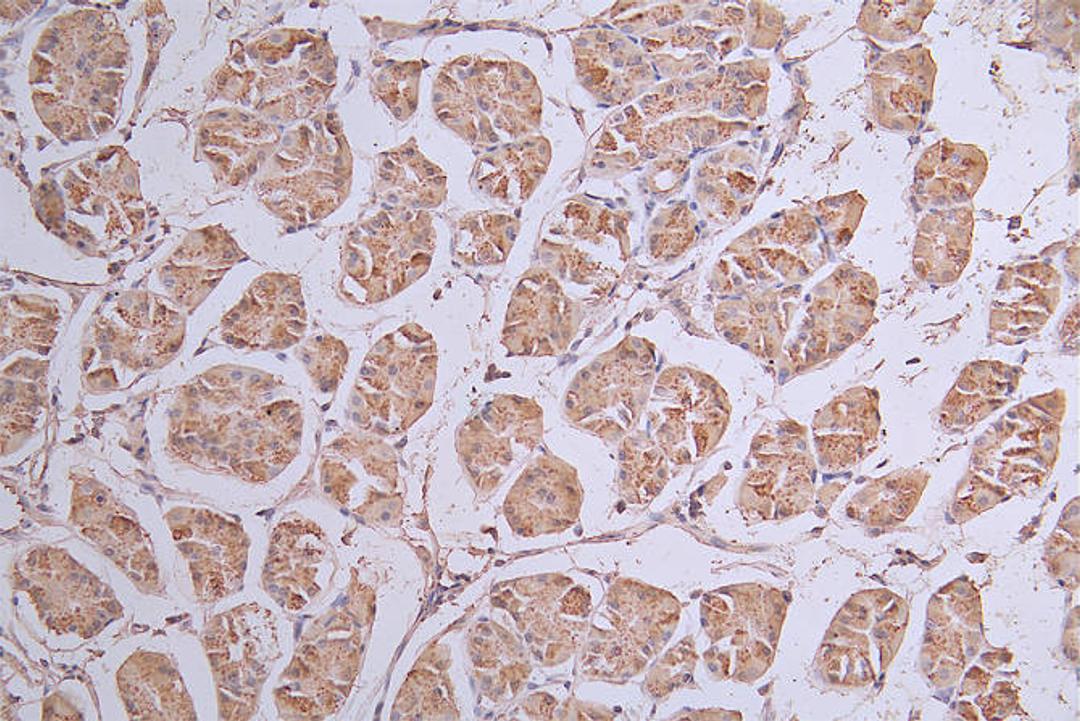 IHC image of CSB-RA443117A0HU diluted at 1:50 and staining in paraffin-embedded human stomach tissue performed on a Leica BondTM system. After dewaxing and hydration, antigen retrieval was mediated by high pressure in a citrate buffer (pH 6.0). Section was blocked with 10% normal goat serum 30min at RT. Then primary antibody (1% BSA) was incubated at 4°C overnight. The primary is detected by a Goat anti-rabbit polymer IgG labeled by HRP and visualized using 0.13% DAB.