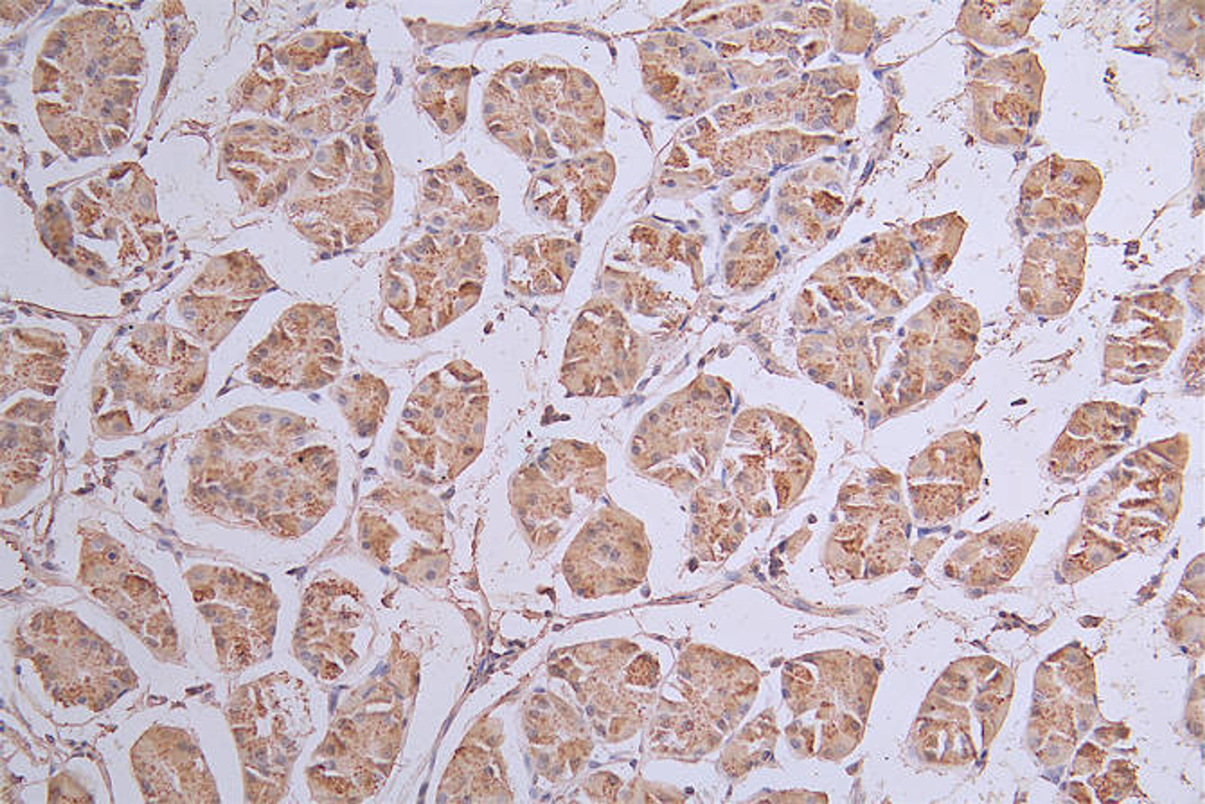 IHC image of CSB-RA443117A0HU diluted at 1:50 and staining in paraffin-embedded human stomach tissue performed on a Leica BondTM system. After dewaxing and hydration, antigen retrieval was mediated by high pressure in a citrate buffer (pH 6.0). Section was blocked with 10% normal goat serum 30min at RT. Then primary antibody (1% BSA) was incubated at 4°C overnight. The primary is detected by a Goat anti-rabbit polymer IgG labeled by HRP and visualized using 0.13% DAB.