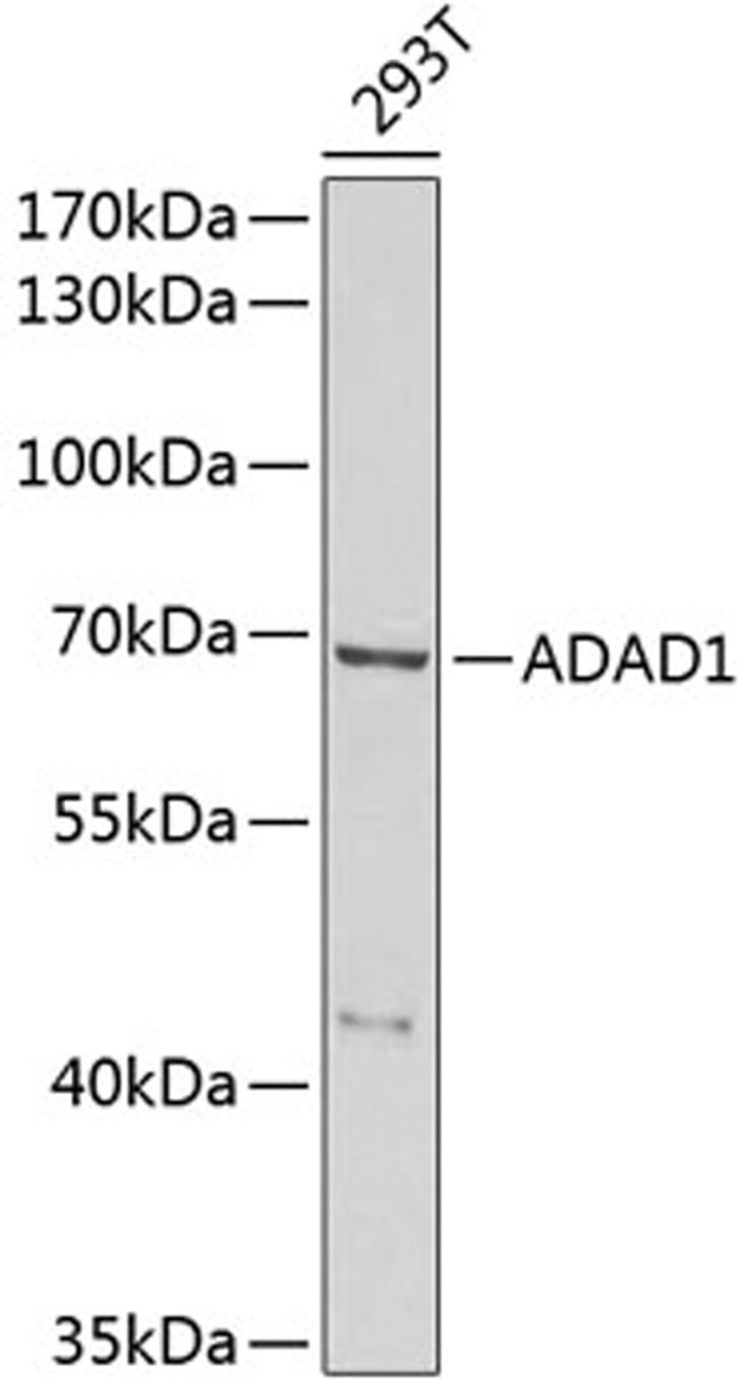 Western blot - ADAD1 antibody (A6491)