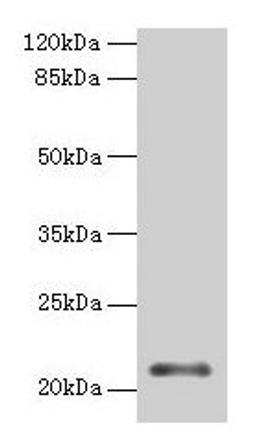 Western blot. All lanes: MOCS2 antibody at 2µg/ml + Jurkat whole cell lysate. Secondary. Goat polyclonal to rabbit IgG at 1/10000 dilution. Predicted band size: 21 kDa. Observed band size: 21 kDa