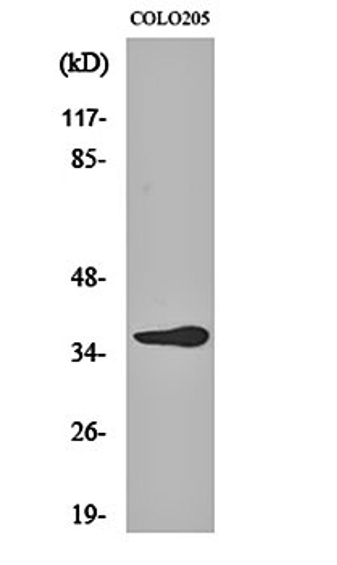 Western blot analysis of COLO205 cell lysates using Olfactory receptor 10G6 antibody