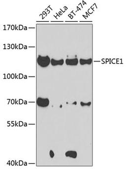 Western blot - SPICE1 antibody (A7855)