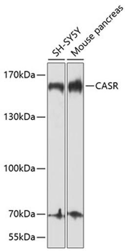 Western blot - CASR antibody (A1426)