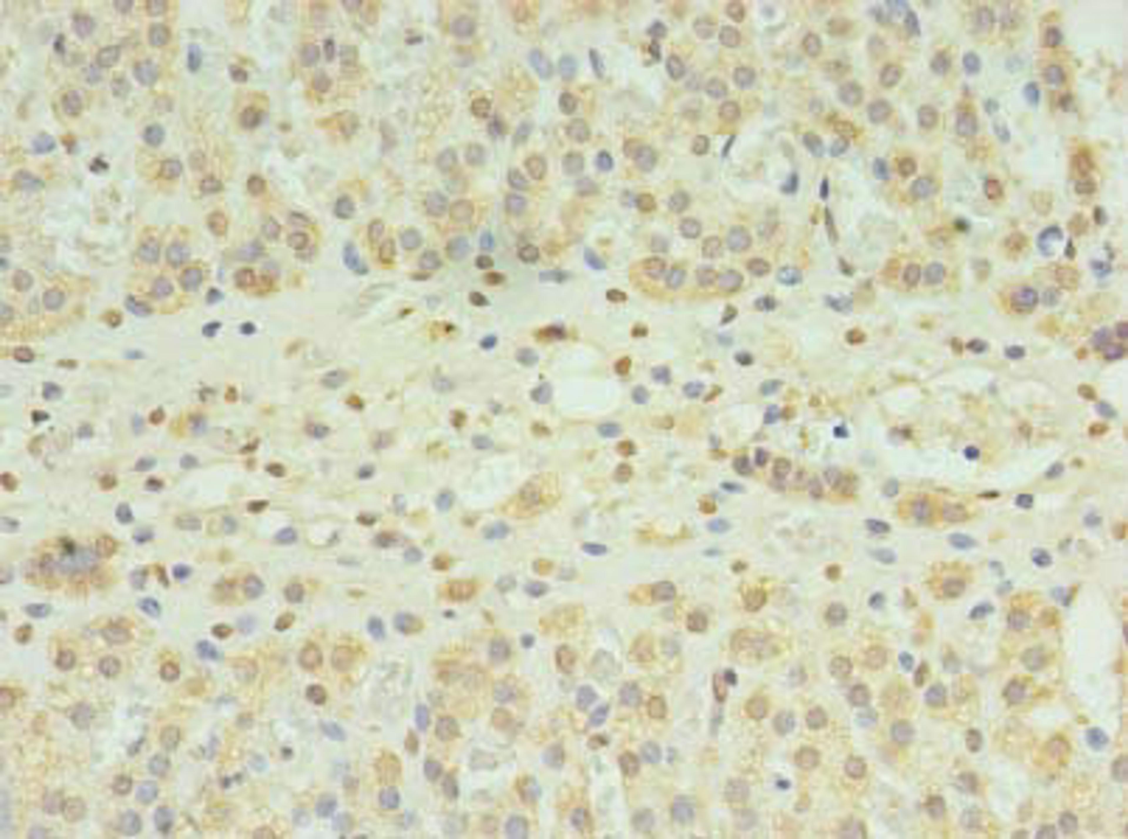Immunohistochemistry of paraffin-embedded human adrenal gland tissue using CSB-PA850799LA01HU at dilution of 1:100