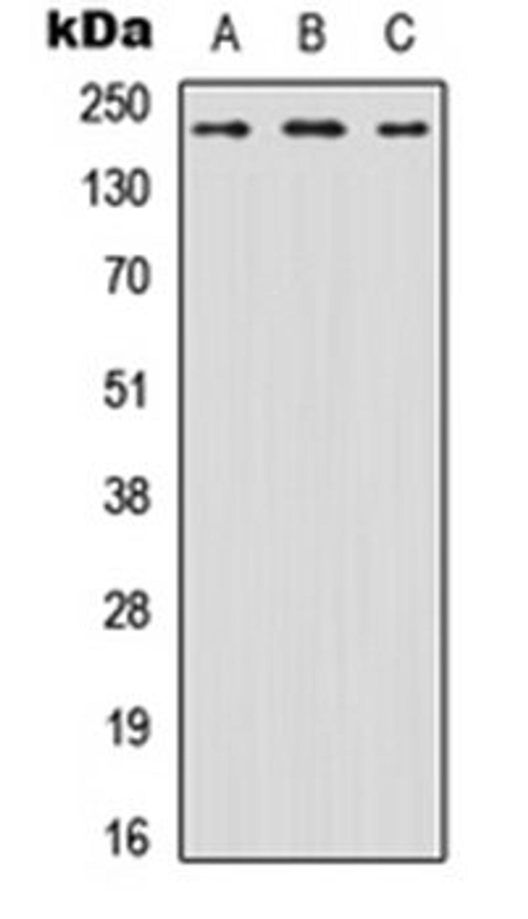 Western blot analysis of HEK293T (Lane 1), Raw264.7 (Lane 2), PC12 (Lane 3) whole cell lysates using Nav1.6 antibody