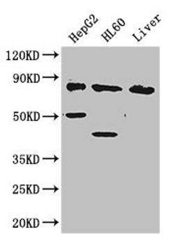 Western Blot. Positive WB detected in: HepG2 whole cell lysate, HL60 whole cell lysate, Mouse liver tissue. All lanes: PFKL antibody at 2.8ug/ml. Secondary. Goat polyclonal to rabbit IgG at 1/50000 dilution. Predicted band size: 86, 91 kDa. Observed band size: 86, 50, 40 kDa.
