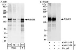 Detection of human RBM26 by western blot and immunoprecipitation.