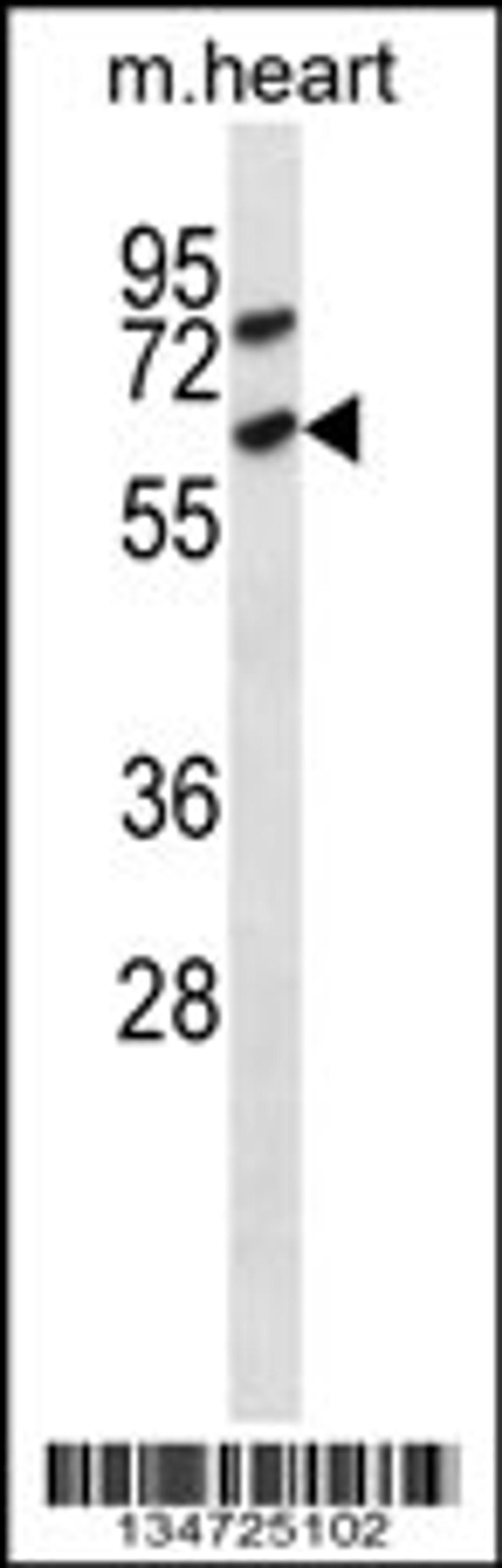 Western blot analysis in mouse heart tissue lysates (35ug/lane).