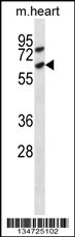 Western blot analysis in mouse heart tissue lysates (35ug/lane).