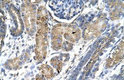 Antibody used in IHC on Human kidney.