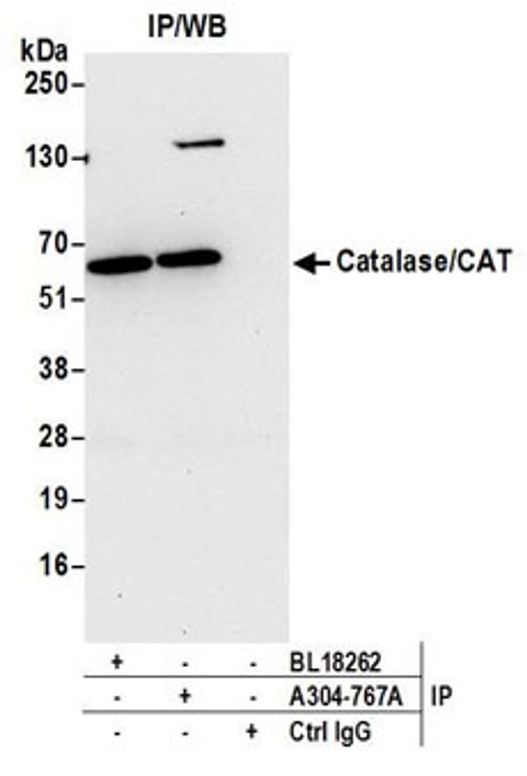 Detection of human Catalase/CAT by western blot of immunoprecipitates.