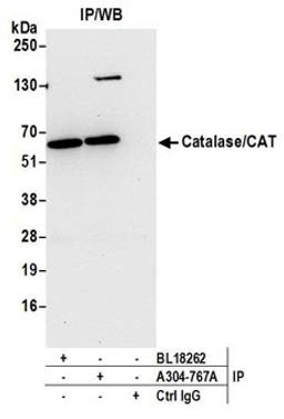 Detection of human Catalase/CAT by western blot of immunoprecipitates.