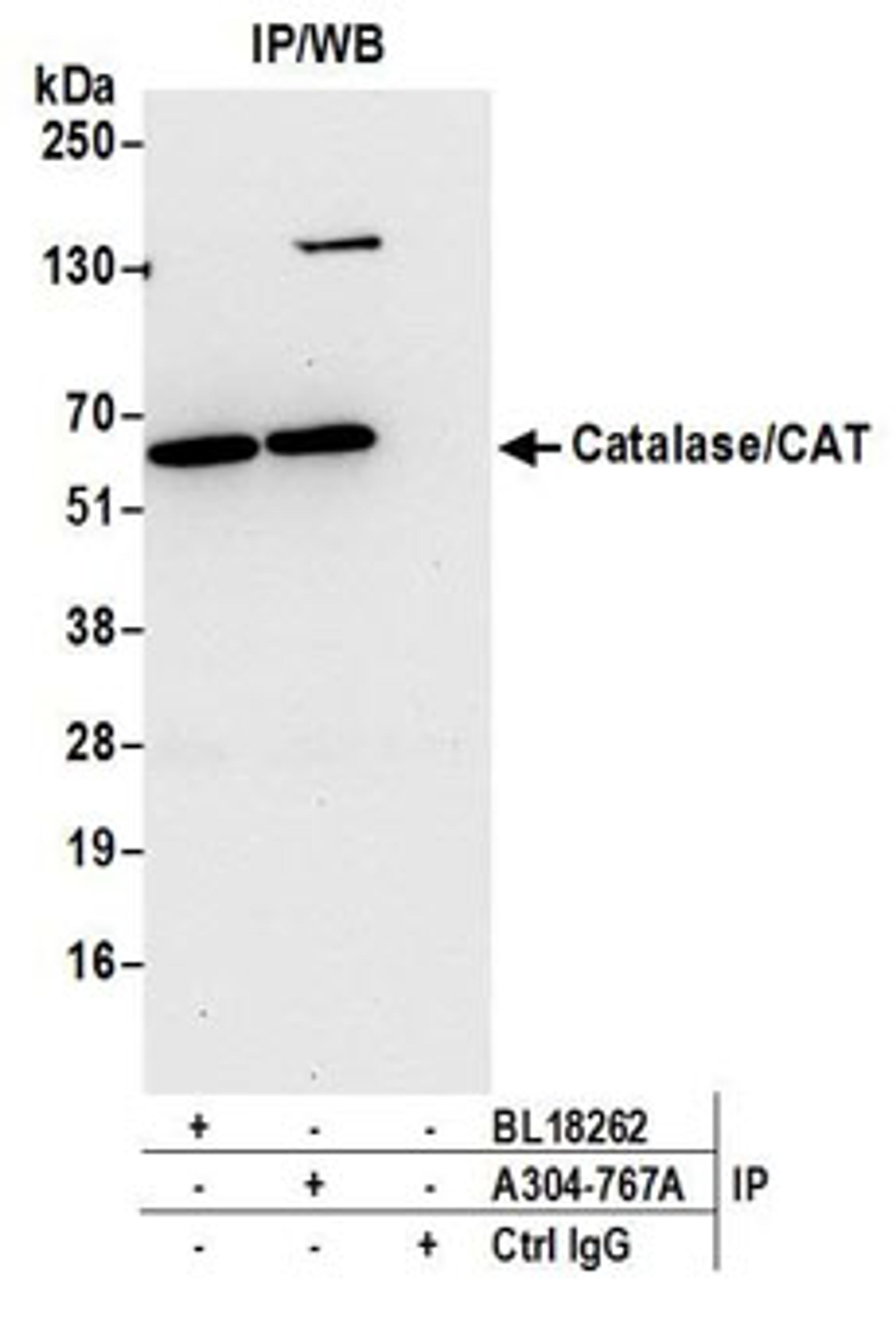 Detection of human Catalase/CAT by western blot of immunoprecipitates.