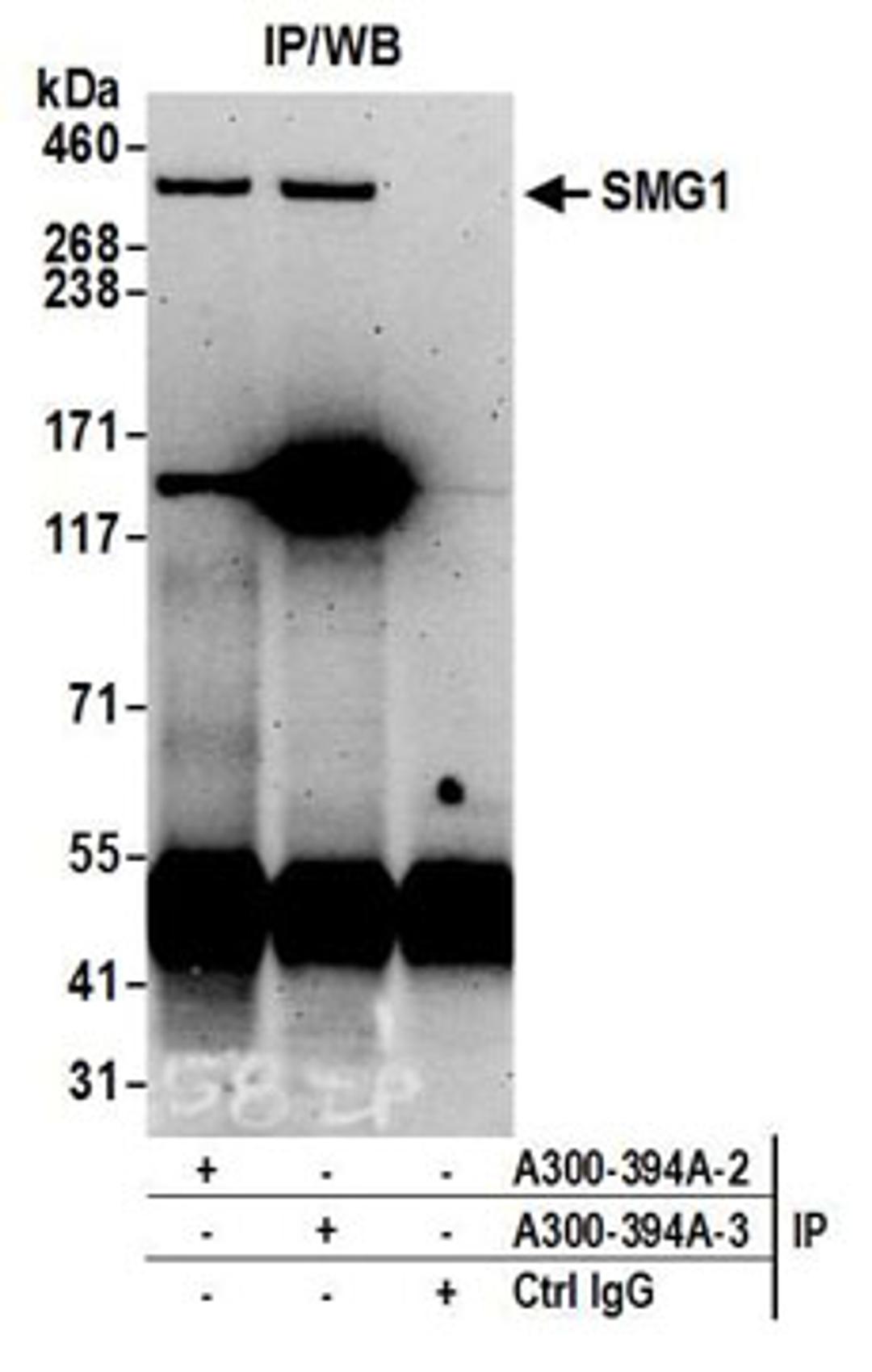 Detection of human SMG1 by western blot of immunoprecipitates.