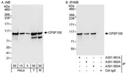 Detection of human and mouse CPSF100 by western blot (h&m) and immunoprecipitation (h).